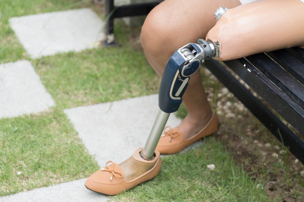 Amputated woman. Female with prosthetic leg sitting outdoor in the garden. Woman handicapper with prosthetic leg. Asian woman with leg prosthesis equipment outdoor